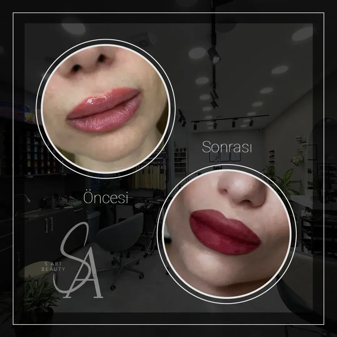 our-courses.lip_filler